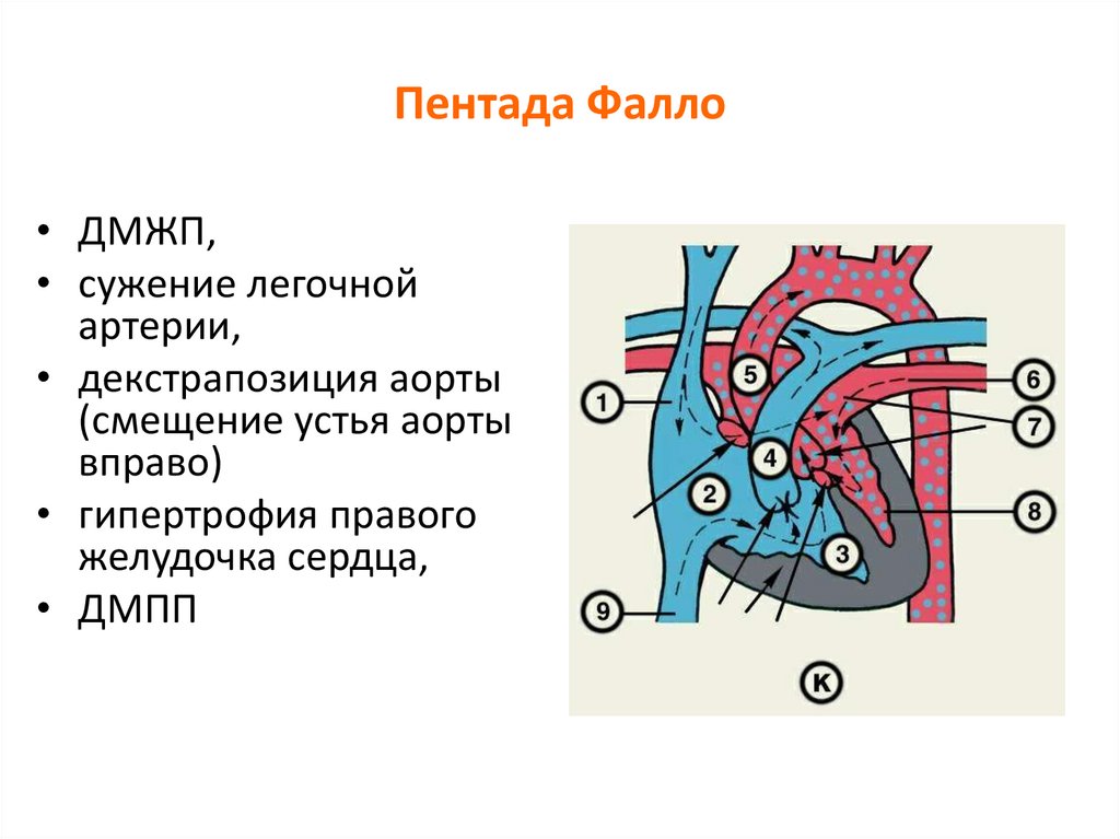 Триада фалло презентация