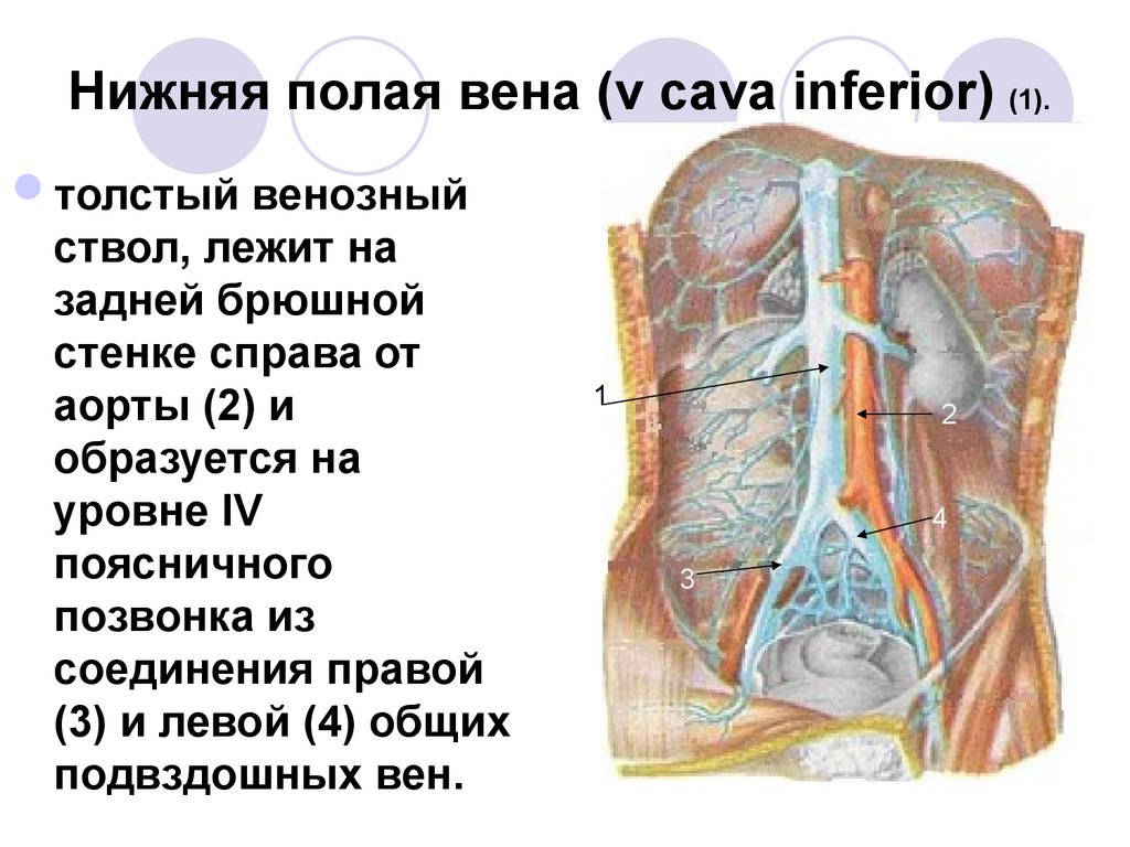 Система верхней полой вены правая половина. Нижняя полая Вена (v. Cava inferior). Нижняя полая Вена образуется на уровне поясничного позвонка. Верхняя и нижняя полая Вена анатомия. Нижняя полая Вена отток.