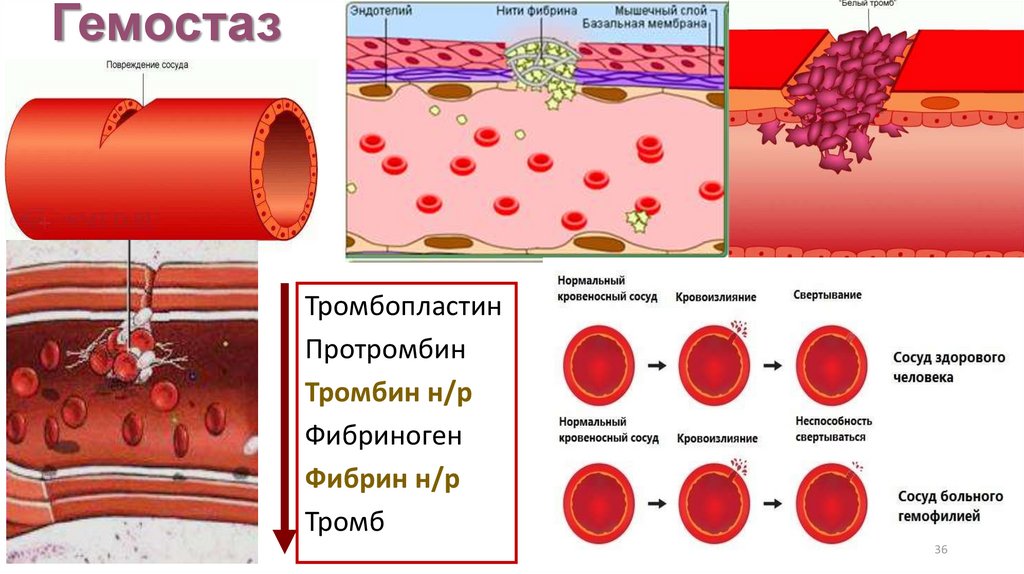 Гемостаз картинки для презентации