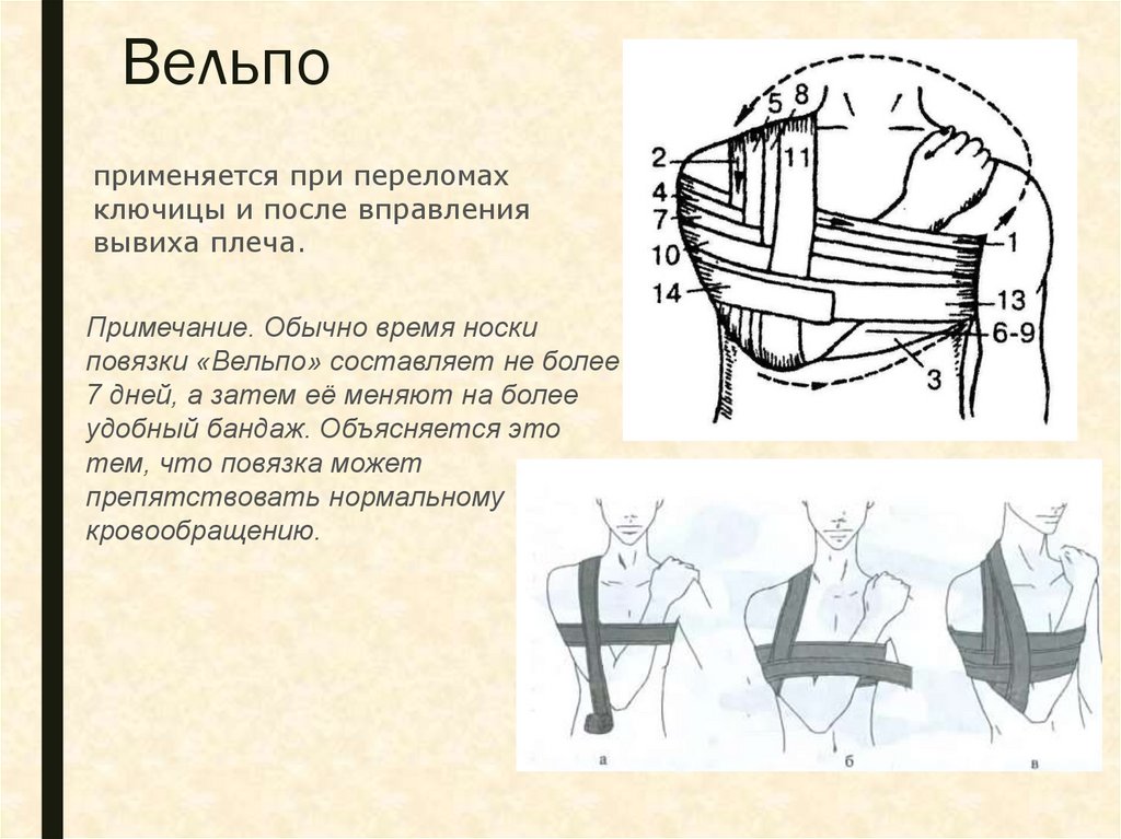 Повязка после вправления вывиха плеча