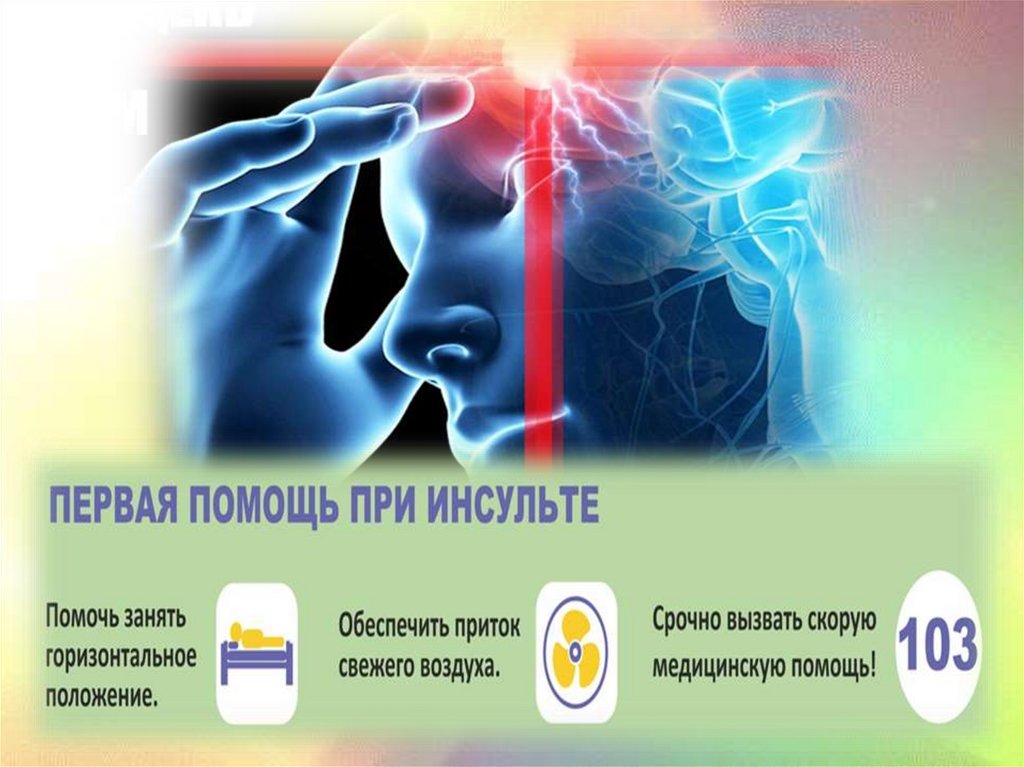 Первая помощь при инсульте презентация