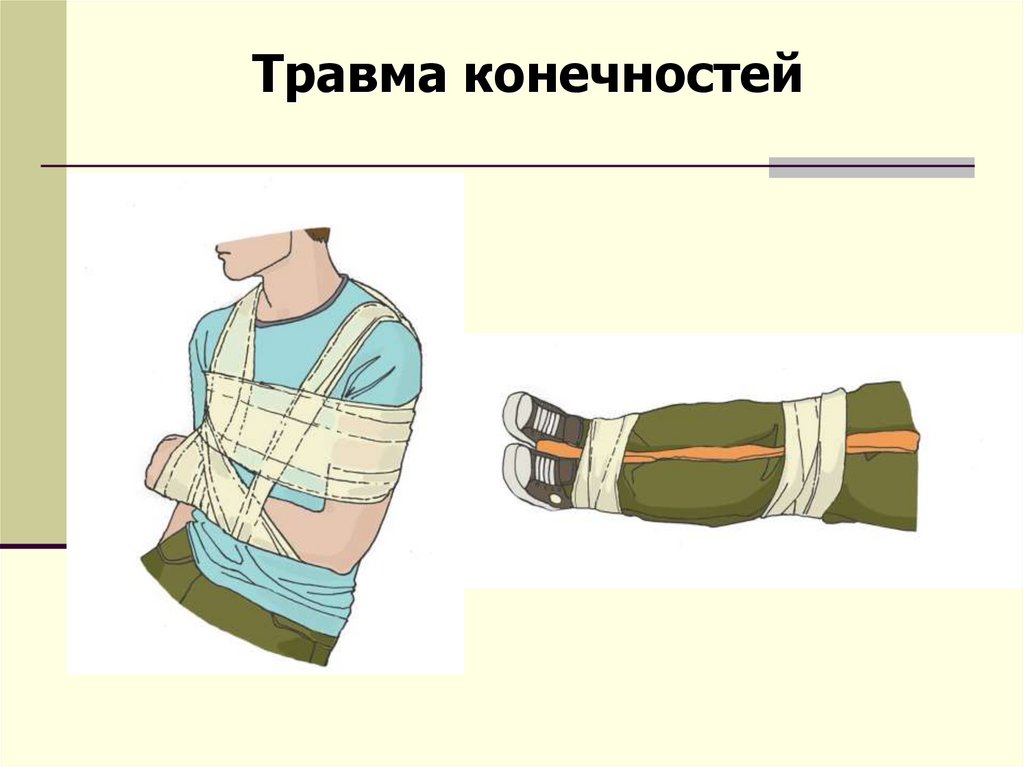 При ранении конечностей. Порядок оказания первой помощи при ранении конечности. Первая помощь при травмах конечностей. Правила оказания первой помощи при ранении конечности.