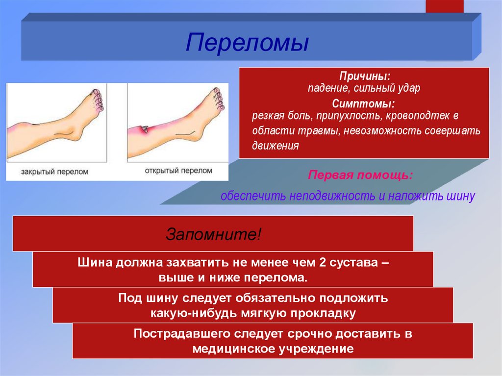 Обж 6 класс закрытые травмы презентация