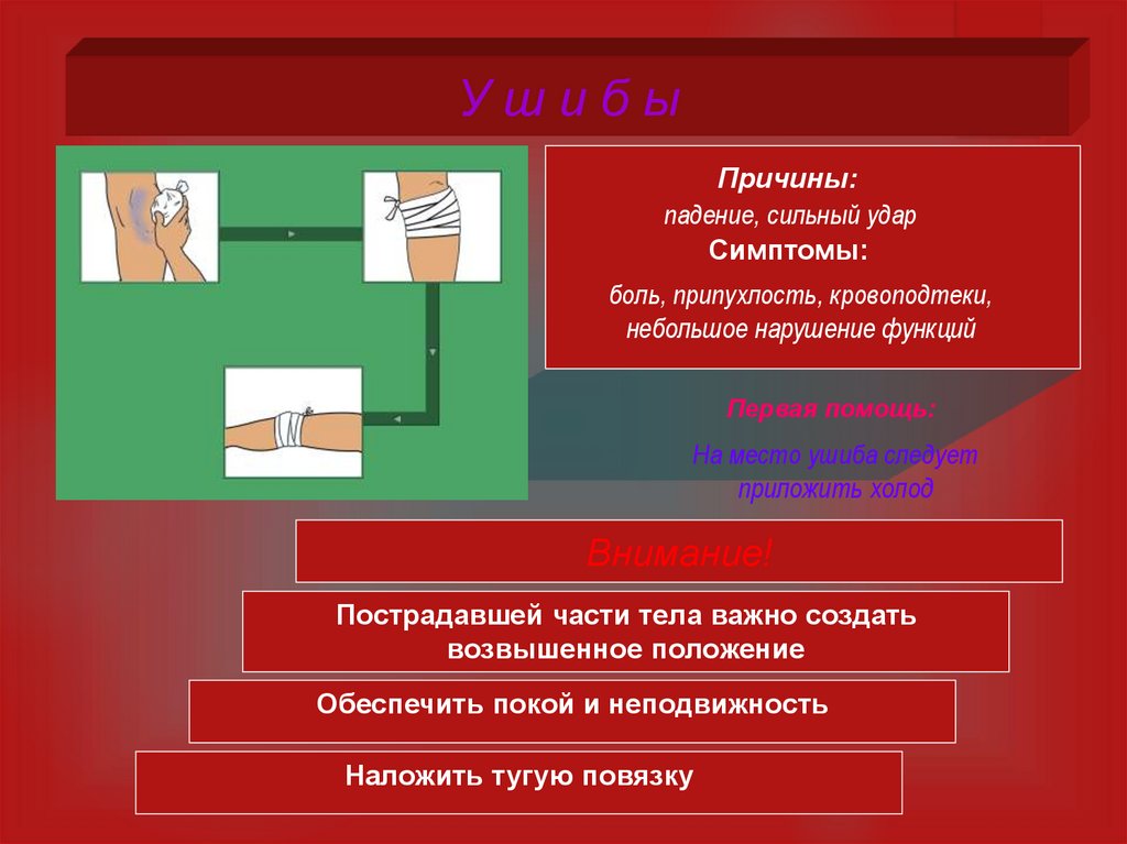 Первая помощь при травмах и ушибах презентация