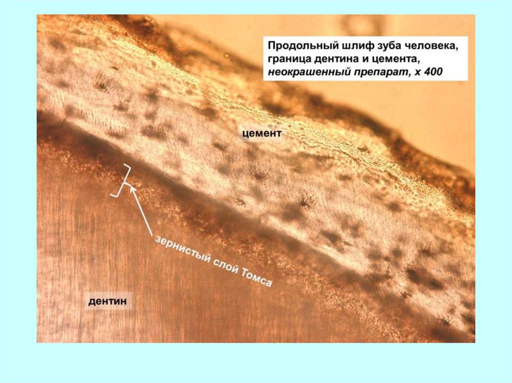 Схема строения зуба гистология