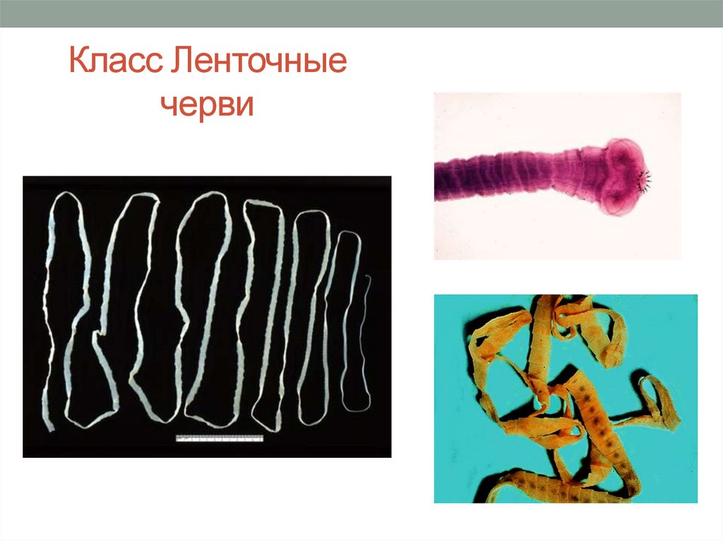 Ленточные и плоские черви. Класс ленточные черви (Cestoda). Представители класса ленточные черви цестоды. Плоские черви ленточные черви. Плоские ленточные черви биология 7 класс.
