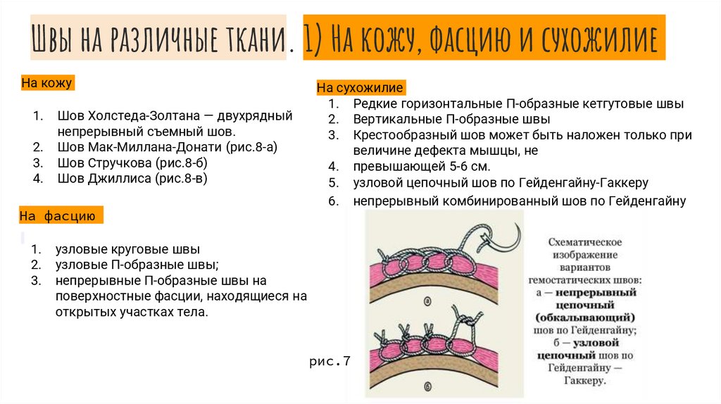 Выбираем шов для перетяжки