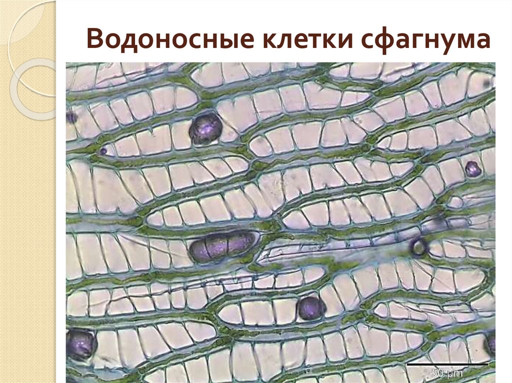 Водоносные клетки сфагнума
