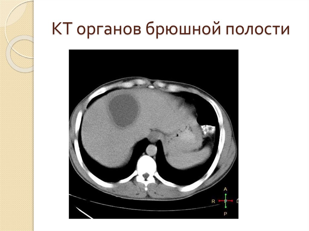 КТ органов брюшной полости