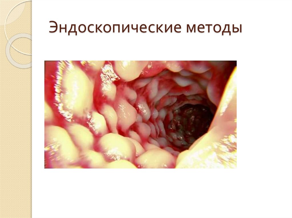 Эндоскопические методы