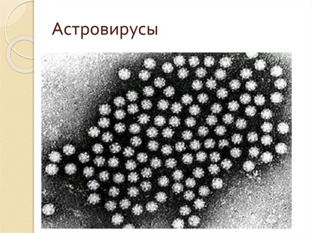 Астровирусная инфекция. Астровирусы строение. Астровирусы характеризуются. Астровирусы микробиология. Астровирусы этиология.