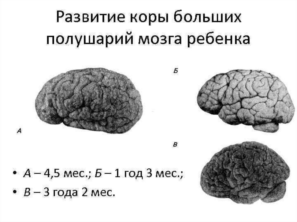 Особенности головного мозга ребенка. Развитие коры больших полушарий головного мозга. Этапы развития коры больших полушарий головного мозга в онтогенезе.. Эмбриональное развитие коры больших полушарий. Развитие коры головного мозга у детей.