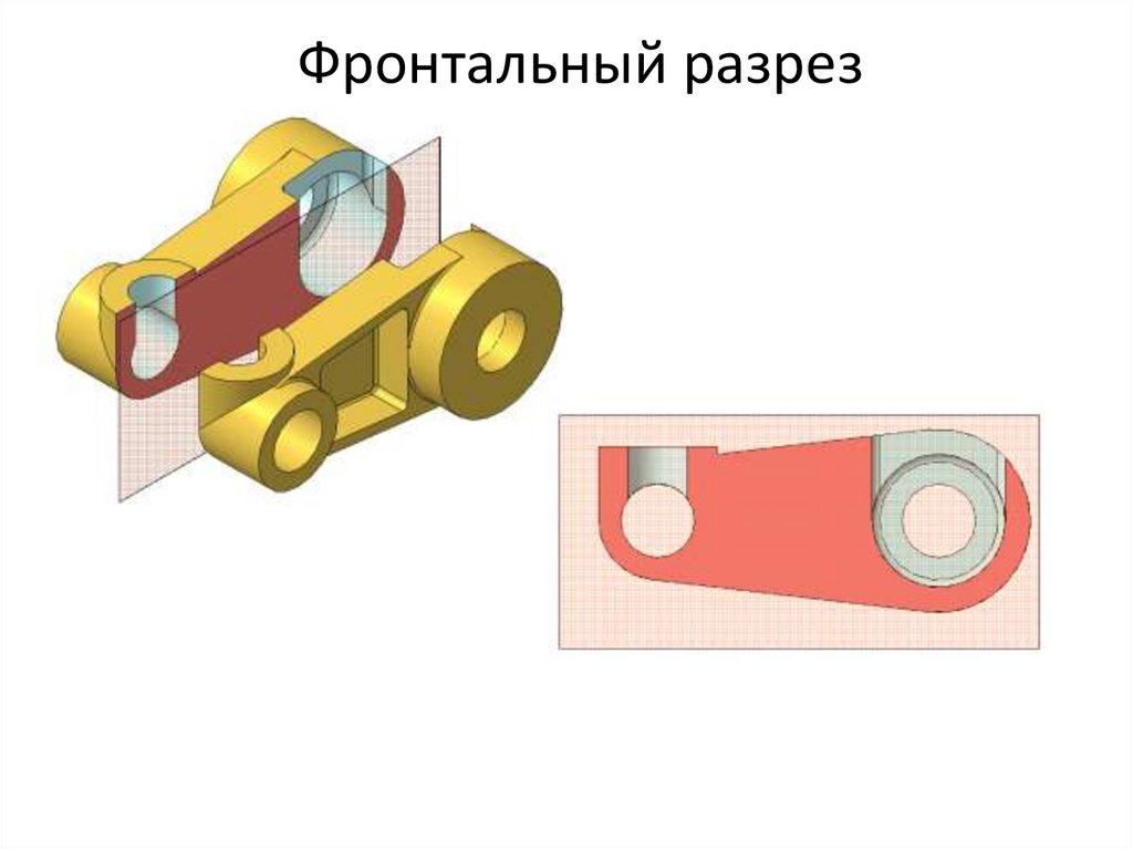 Фронтальный разрез