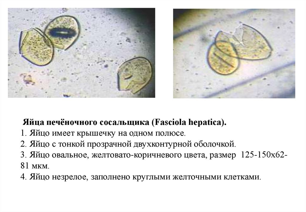 Печеночный сосальщик диагностика. Fasciola яйца. Яйца Fasciola hepatica размер. Яйца печеночного сосальщика. Яйцо печеночного сосальщика препарат.