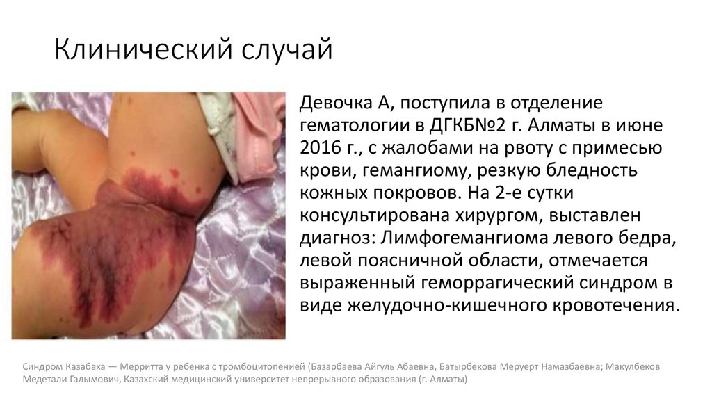 Клинический случай