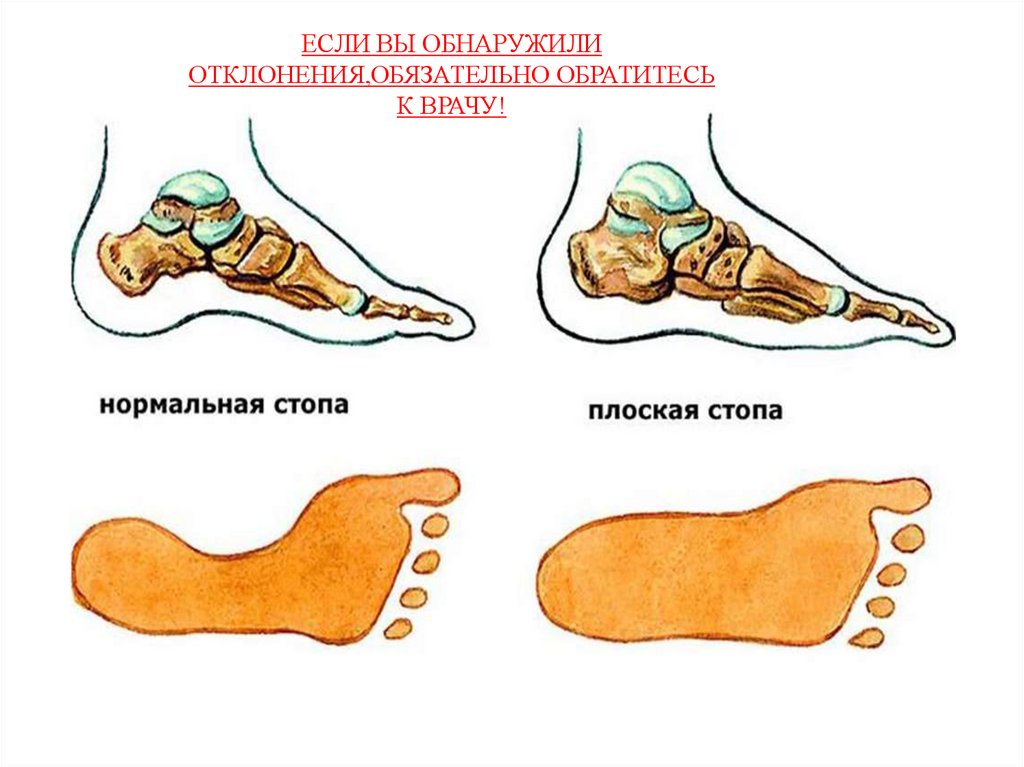 Тестовая карта для выявления нарушений осанки