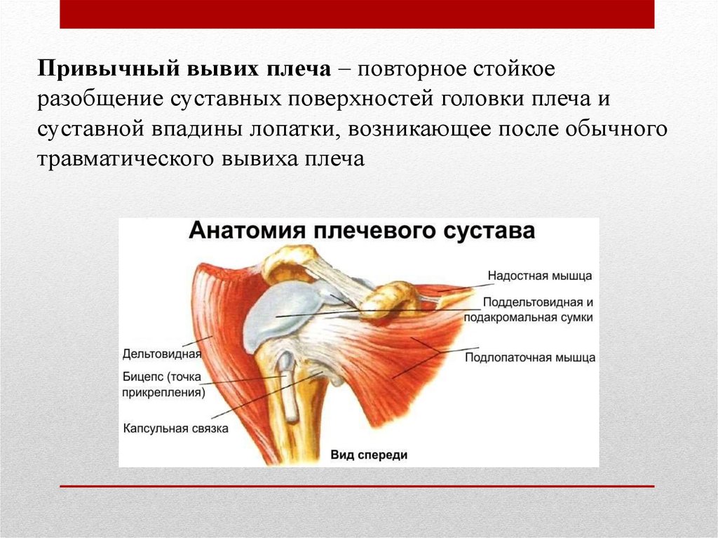 Привычный вывих плечевого сустава. Растяжение связок плеча.