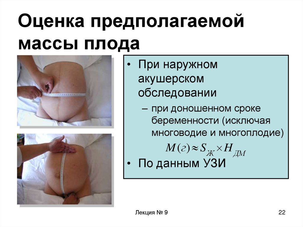 Вдм при беременности по неделям. Измерение окружности живота и высоты дна матки. Измерения окружности живота и высоты дна матки у беременных. Измерение высоты стояния дна матки у беременной. Высота дна матки вес плода 38.