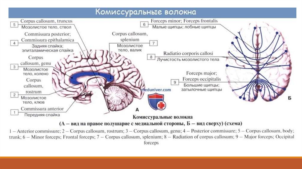 Воспаление головного мозга латынь. Комиссуральные волокна конечного мозга. Комиссуральные проводящие пути головного мозга. Комиссуральные волокна мозолистого тела. Белое вещество мозга комиссуральные волокна.