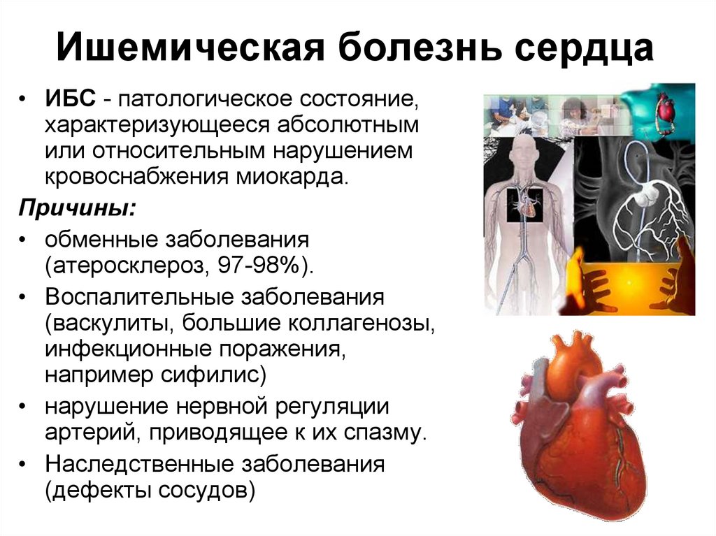 Почему ишемия. Ишемия сердца причины возникновения. Ишемическая болезнь сердца причины заболевания. Ишемическая болезнь сердца (ИБС).