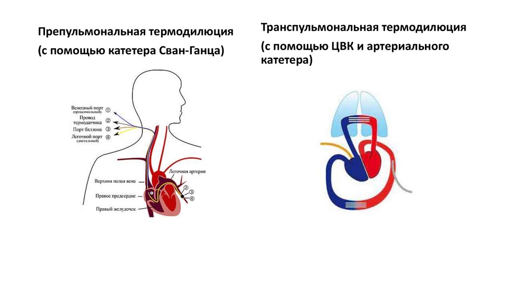 Гипертонический тип