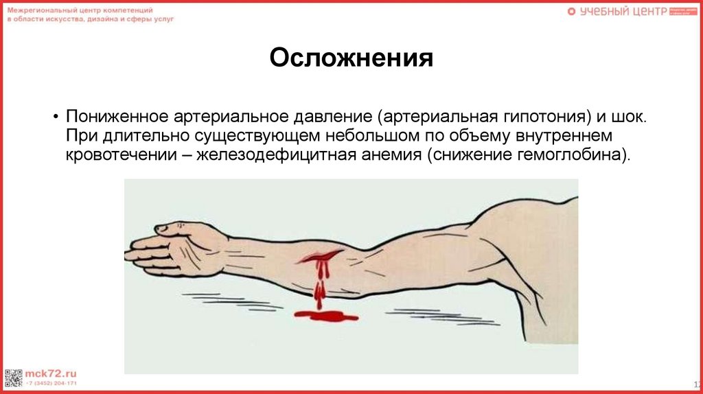 Осложнения