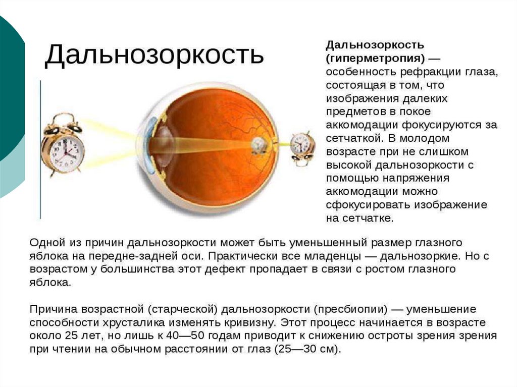 Оптическая система глаза презентация. Глаз как оптическая система. Оптические системы презентация. Глаз как оптическая система зрение.