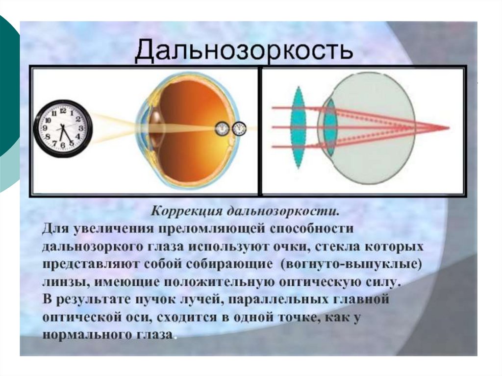 Оптическая система глаза физика. Глаз как оптическая система. Оптическая система глаза презентация. Оптические системы презентация.