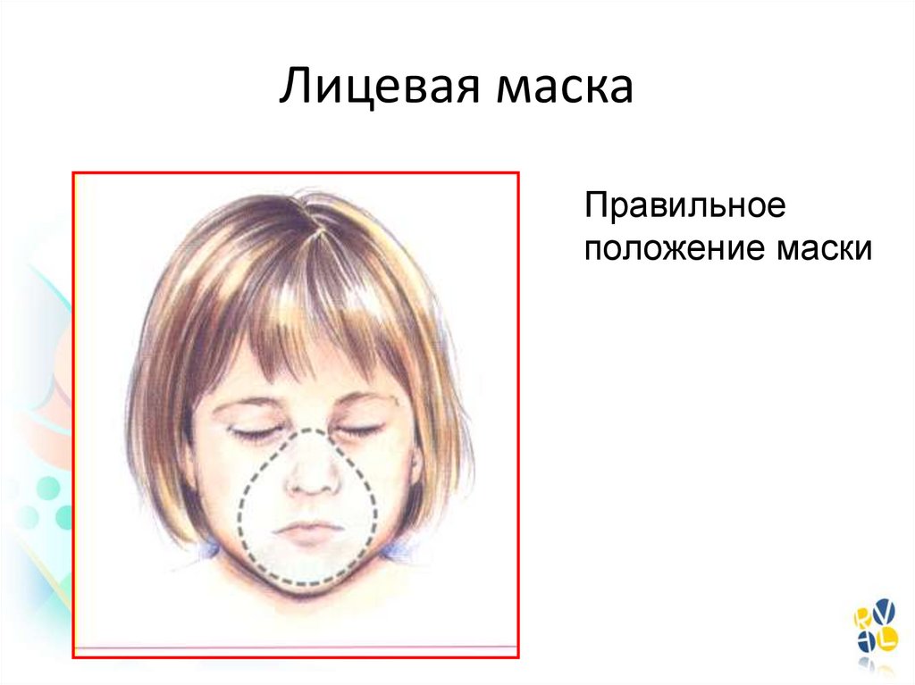 Размеры лицевой маски. Маска лицевая (детская). Корректировки положения маски. Неадекватное прижатие лицевой маски. Схема картинка новорожденный лицевая маска.