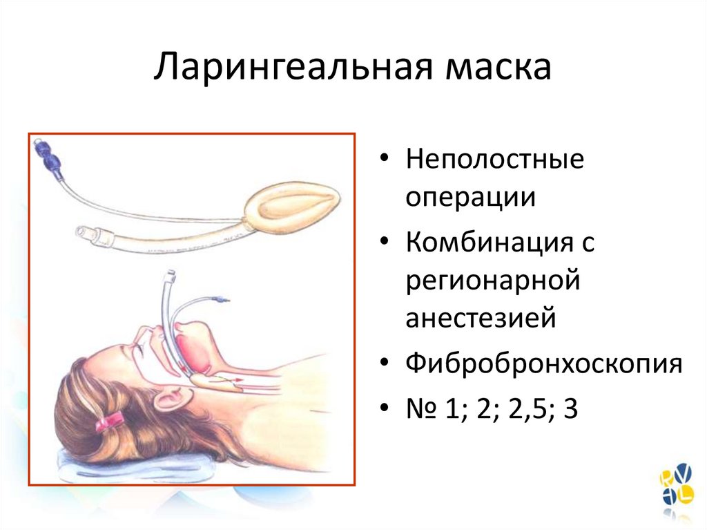 Регионарная анестезия у детей презентация