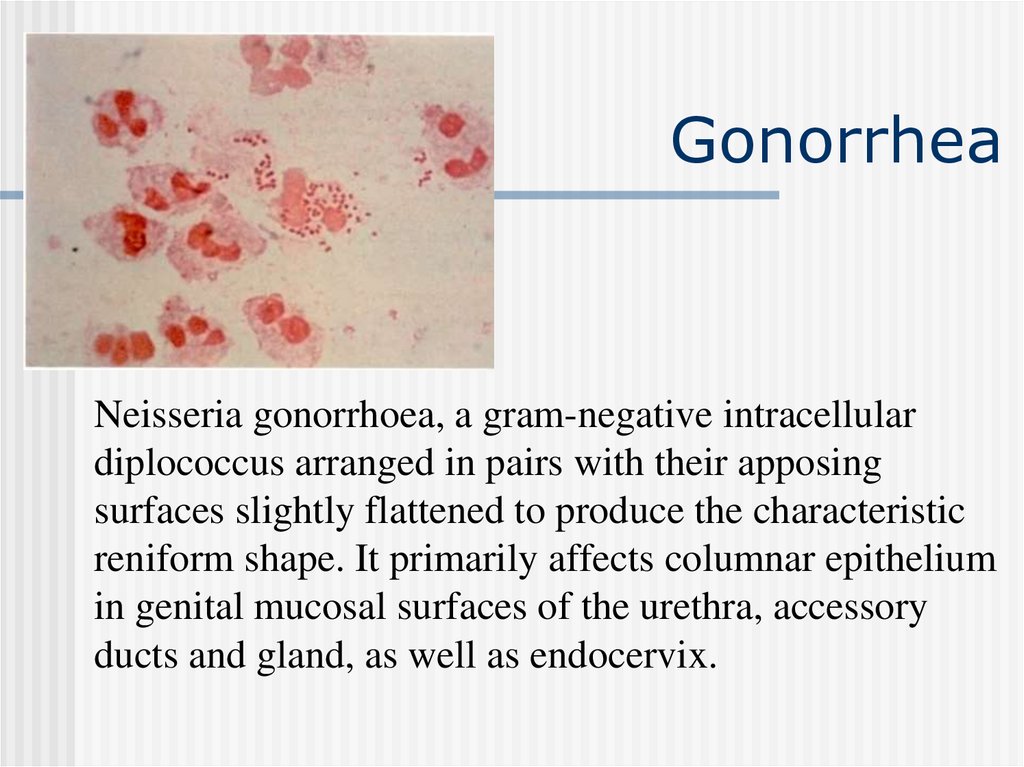 gonorrhea pdf download