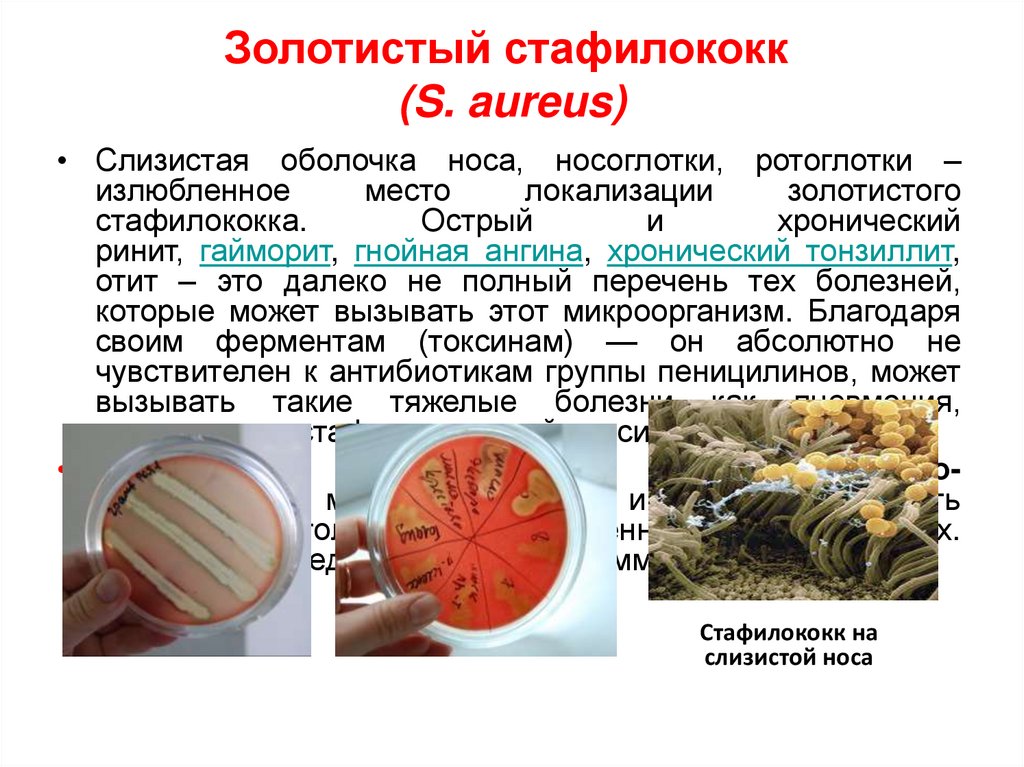 Staphylococcus aureus 4. Золотистый стафилокоо. Бактерия золотистый стафилококк. Бактерия золотистый стафилококк доклад. Сообщение о бактерии стафилококки.