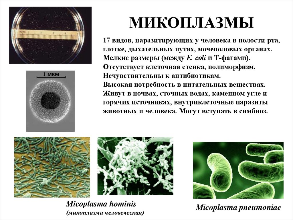 Бактерии являются паразитами животных. Микоплазмы на питательной среде. Микоплазмы внутриклеточные паразиты. Культивирование микоплазм микробиология. Микоплазмы мембранный паразитизм.