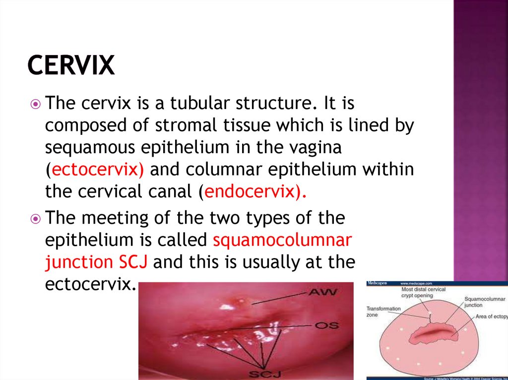 Premalignant Conditions Of The Cervix Online Presentation