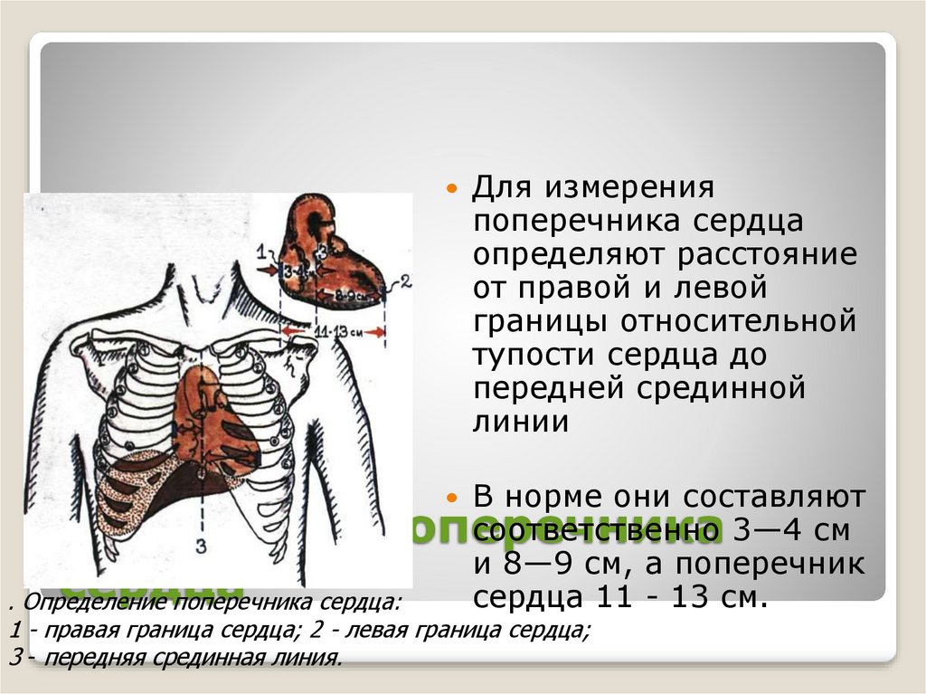 Поперечник. Поперечник и длинник сердца в норме. Поперечник относительной тупости сердца в норме. Измерение поперечника сердца. Расширение границ сердца в поперечнике.