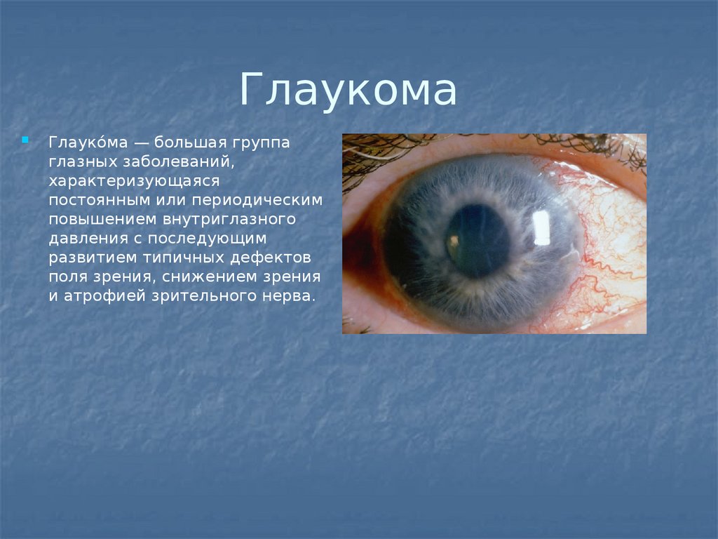 Признаки больных глаз. Презентация заболевания глаз. Доклад на тему заболевания глаза.