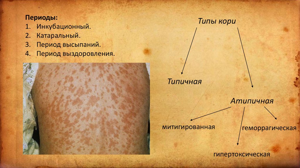 Корь - презентация онлайн
