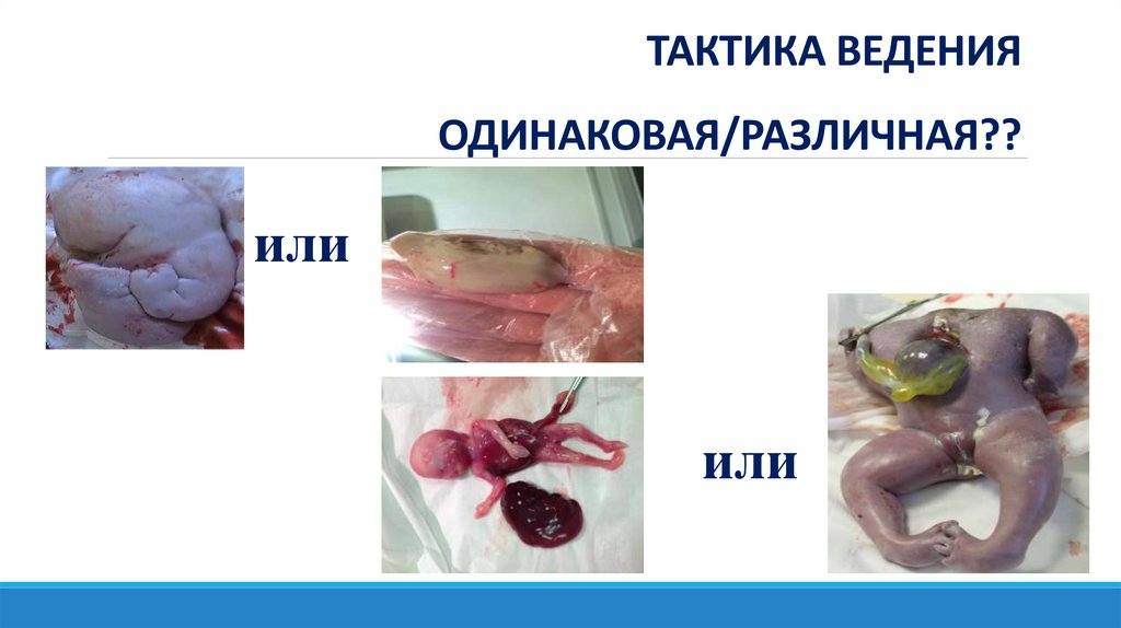 ТАКТИКА ВЕДЕНИЯ ОДИНАКОВАЯ/РАЗЛИЧНАЯ??