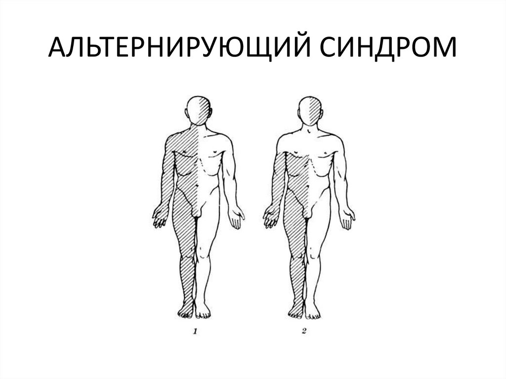 В формировании клинической картины синдрома джексона участвует черепной нерв