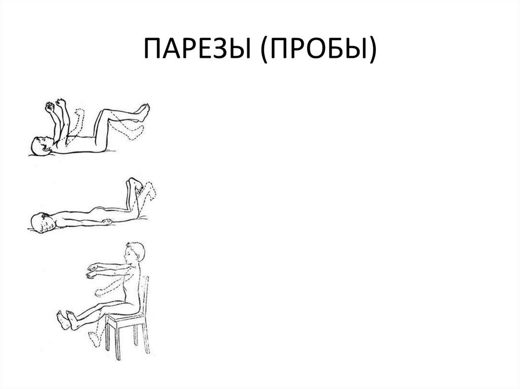 ПАРЕЗЫ (ПРОБЫ)