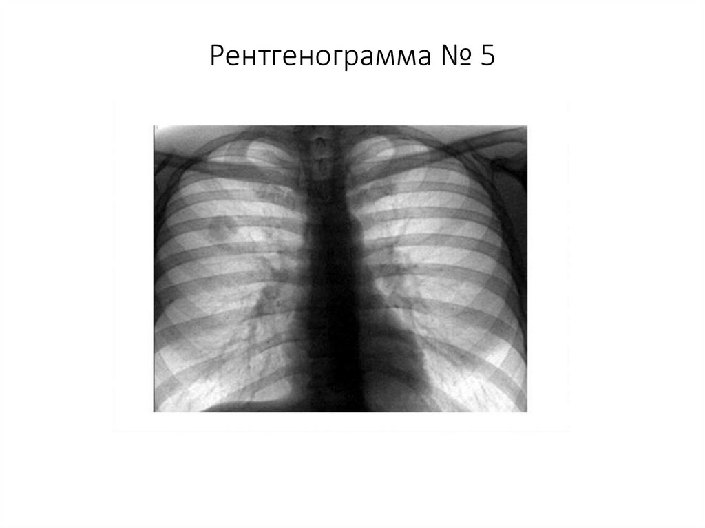 Рентгенограмма № 5