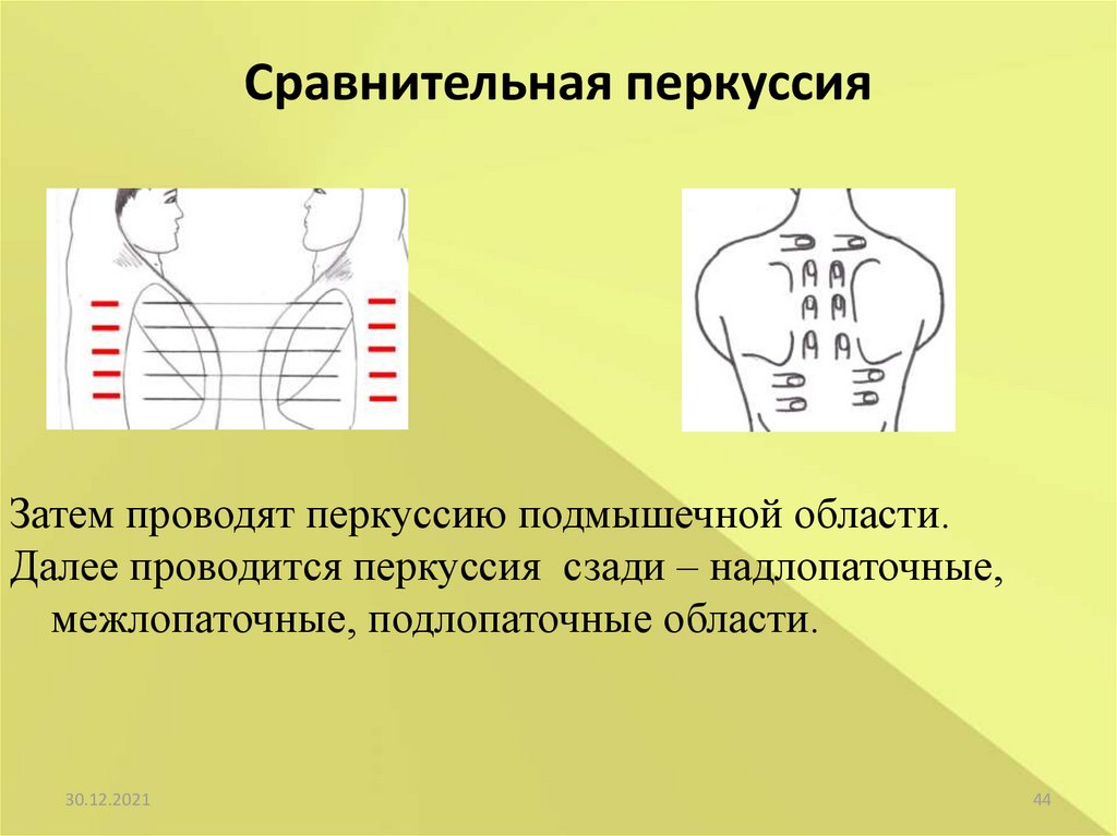 Перкуссия легких схема