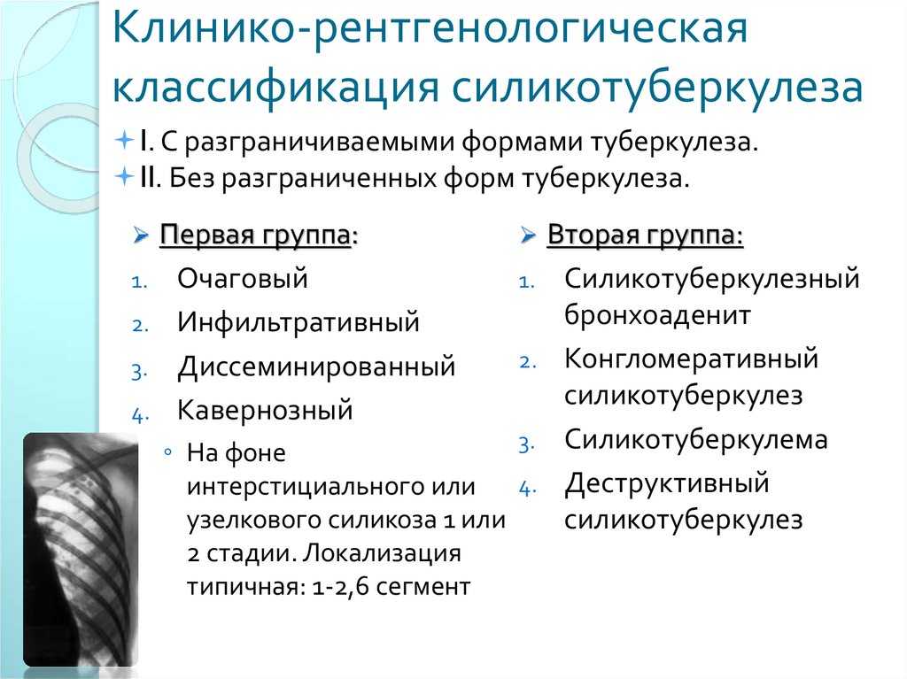 Клинико-рентгенологическая классификация силикотуберкулеза