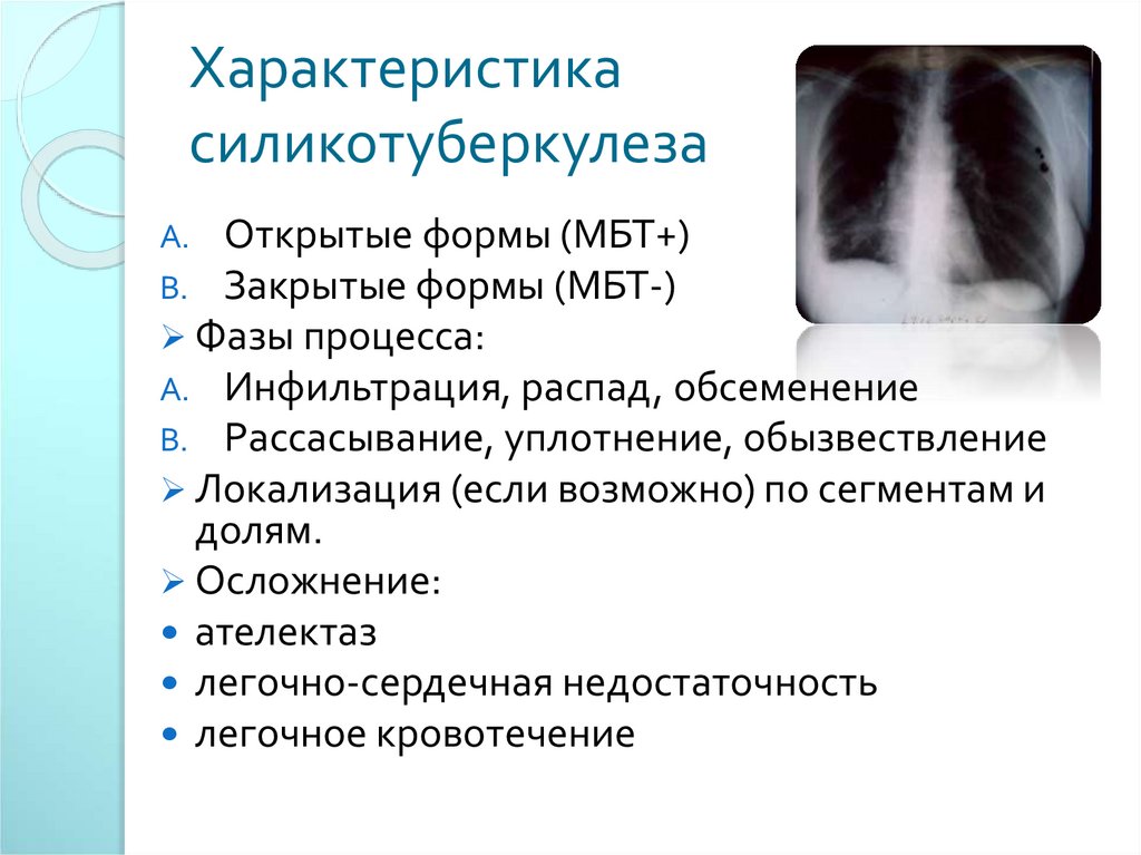 Характеристика силикотуберкулеза