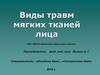 Виды травм мягких тканей лица