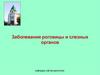 Заболевания роговицы. Лекция 4