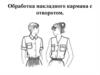 Обработка накладного кармана с отворотом