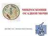 Микроскопия осадков мочи