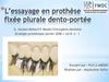 L’essayage en prothèse fixée plurale dento-portée