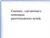 Снимки , сделанные с помощью рентгеновских лучей